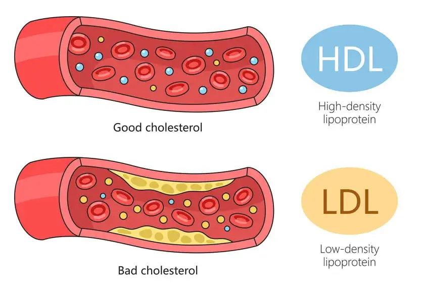 Cholesterol Article